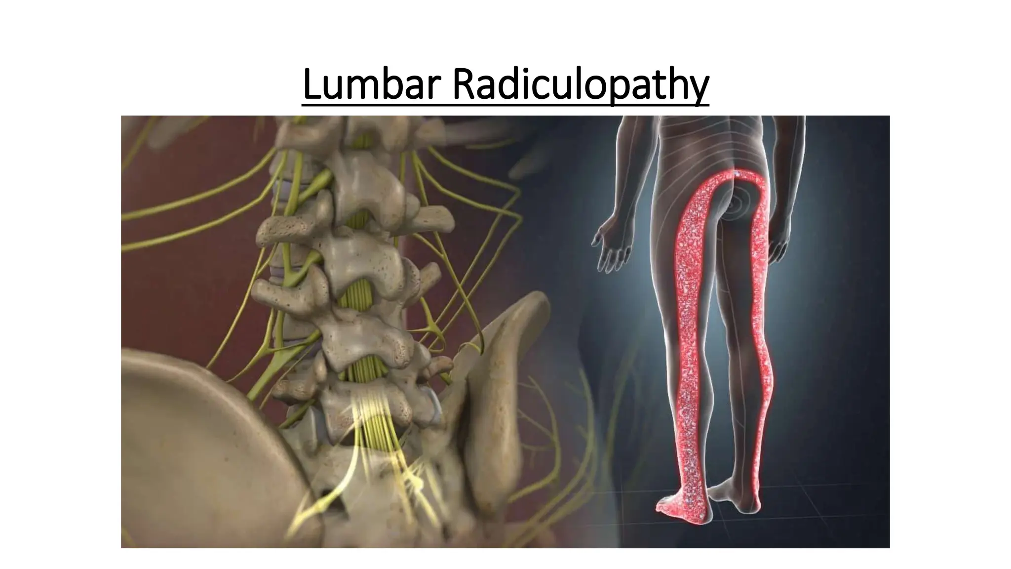 Low back pain differential diagnosis and treatment | PPTX