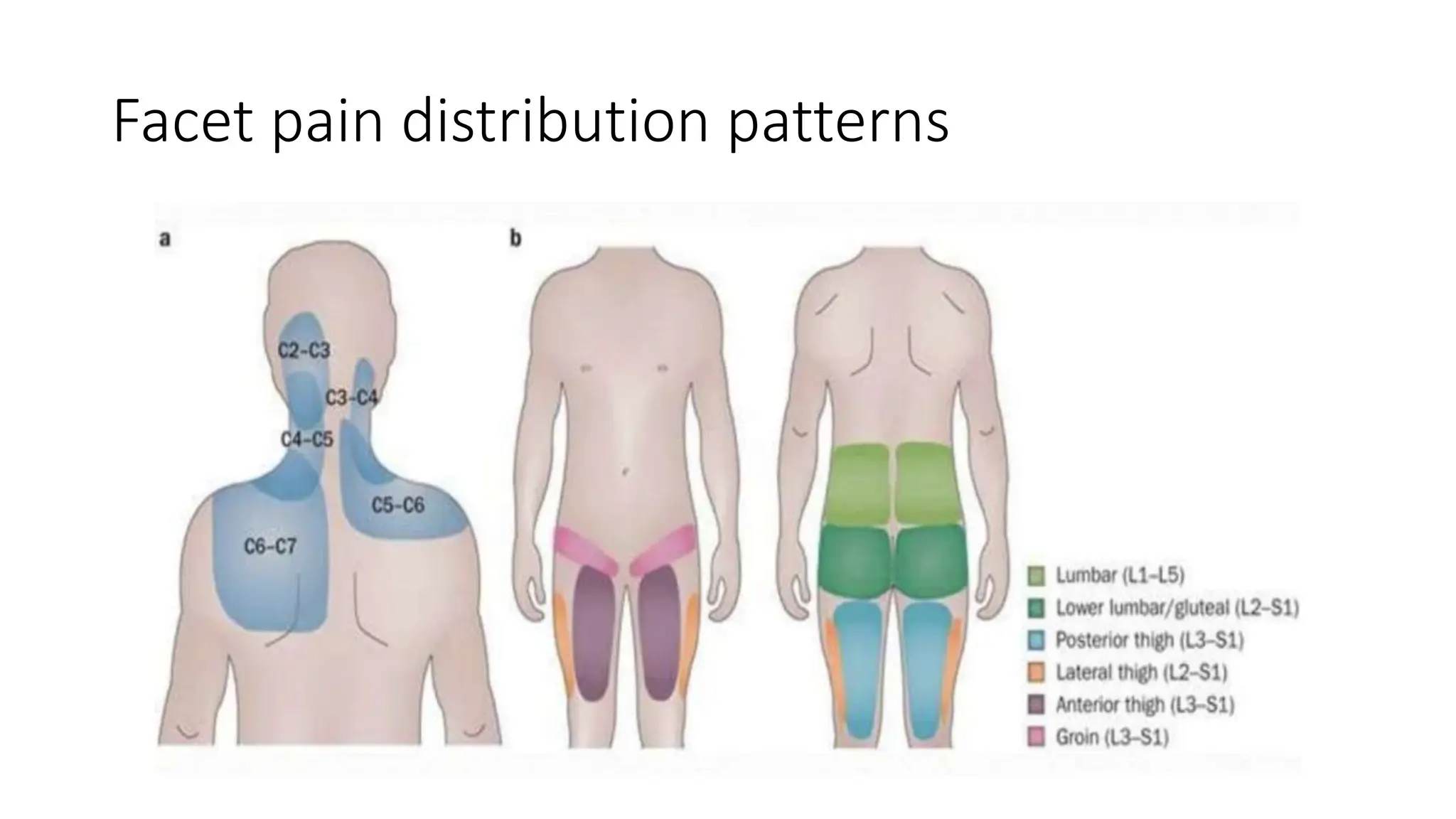 Low back pain differential diagnosis and treatment | PPTX