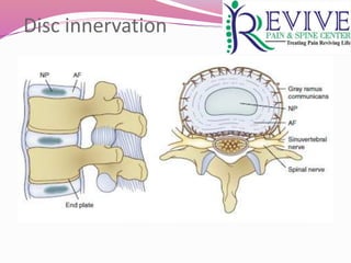 Disc innervation
 