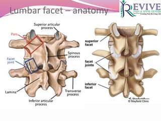 Lumbar facet – anatomy
 