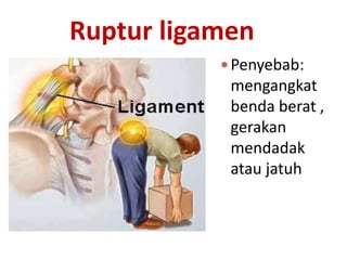 Ruptur ligamen
Penyebab:
mengangkat
benda berat ,
gerakan
mendadak
atau jatuh
 