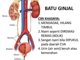 BATU GINJAL
CIRI KHASNYA:
1.MENDADAK, HILANG
TIMBUL
2.Nyeri seperti DIREMAS-
REMAS (KOLIK)
3.Sangat nyeri bila DIPUKUL
pada daerah CVA
4.Urin (air seni) keruh atau
kemerahan
 