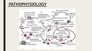 PATHOPHYSIOLOGY
 