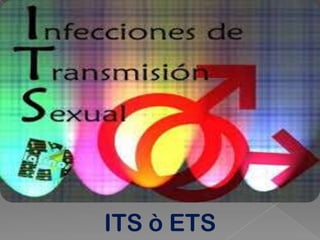 ITS ò ETS
 