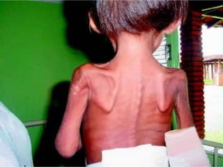 áLbum de fotografias teste