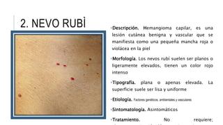 ÀLBUM FOTOGRÀFICO DE DERMATOLOGÌA.pptx máculas, pápulas y otras ...
