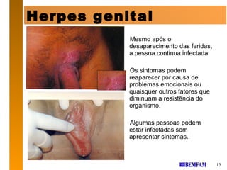 Herpes genital
           Mesmo após o
           desaparecimento das feridas,
           a pessoa continua infectada.

           Os sintomas podem
           reaparecer por causa de
           problemas emocionais ou
           quaisquer outros fatores que
           diminuam a resistência do
           organismo.

           Algumas pessoas podem
           estar infectadas sem
           apresentar sintomas.



                                          15
 