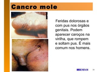 Cancro mole

          Feridas dolorosas e
          com pus nos órgãos
          genitais. Podem
          aparecer caroços na
          virilha, que rompem
          e soltam pus. É mais
          comum nos homens.




                                 18
 