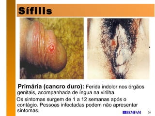 Sífilis




Primária (cancro duro): Ferida indolor nos órgãos
genitais, acompanhada de íngua na virilha.
Os sintomas surgem de 1 a 12 semanas após o
contágio. Pessoas infectadas podem não apresentar
sintomas.                                           26
 
