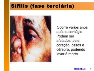 Sífilis (fase terciária)



                 Ocorre vários anos
                 após o contágio.
                 Podem ser
                 afetados: pele,
                 coração, ossos e
                 cérebro, podendo
                 levar à morte.


                                      28
 