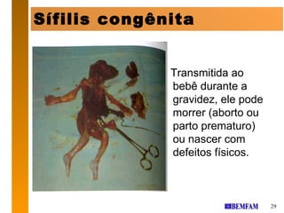 Sífilis congênita


              Transmitida ao
              bebê durante a
              gravidez, ele pode
              morrer (aborto ou
              parto prematuro)
              ou nascer com
              defeitos físicos.



                                   29
 