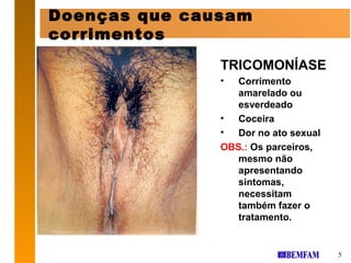 Doenças que causam
corrimentos
               TRICOMONÍASE
               •  Corrimento
                  amarelado ou
                  esverdeado
               •  Coceira
               •  Dor no ato sexual
               OBS.: Os parceiros,
                  mesmo não
                  apresentando
                  sintomas,
                  necessitam
                  também fazer o
                  tratamento.


                                      5
 