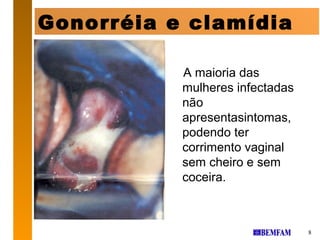 Gonorréia e clamídia

           A maioria das
           mulheres infectadas
           não
           apresentasintomas,
           podendo ter
           corrimento vaginal
           sem cheiro e sem
           coceira.



                                 8
 