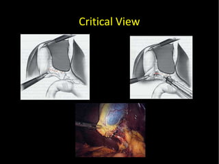 20/01/14
Critical View
 
