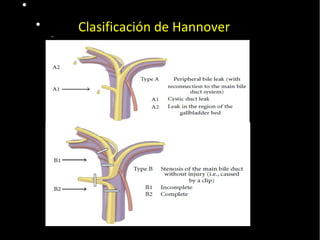  Pulse para editar los formatos del
texto del esquema
 Segundo nivel del esquema
− Tercer nivel del esquema
 Cuarto nivel del
esquema
− Quinto nivel
del esquema
− Sexto nivel
del esquema
− Séptimo
nivel del
esquema
− Octavo nivel
del esquema
Noveno nivel del esquemaHaga clic para
modificar el estilo de texto del
patrón
20/01/14
Clasificación de Hannover
 