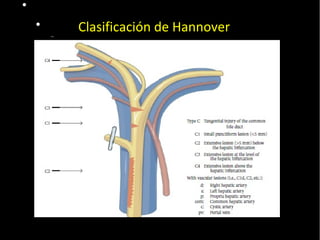  Pulse para editar los formatos del
texto del esquema
 Segundo nivel del esquema
− Tercer nivel del esquema
 Cuarto nivel del
esquema
− Quinto nivel
del esquema
− Sexto nivel
del esquema
− Séptimo
nivel del
esquema
− Octavo nivel
del esquema
Noveno nivel del esquemaHaga clic para
modificar el estilo de texto del
patrón
20/01/14
Clasificación de Hannover
 