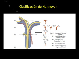  Pulse para editar los formatos del
texto del esquema
 Segundo nivel del esquema
− Tercer nivel del esquema
 Cuarto nivel del
esquema
− Quinto nivel
del esquema
− Sexto nivel
del esquema
− Séptimo
nivel del
esquema
− Octavo nivel
del esquema
Noveno nivel del esquemaHaga clic para
modificar el estilo de texto del
patrón
20/01/14
Clasificación de Hannover
 