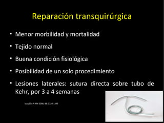 20/01/14
Reparación transquirúrgica
• Menor morbilidad y mortalidad
• Tejido normal
• Buena condición fisiológica
• Posibilidad de un solo procedimiento
• Lesiones laterales: sutura directa sobre tubo de
Kehr, por 3 a 4 semanas
Surg Clin N AM 2008; 88: 1329-1343
 