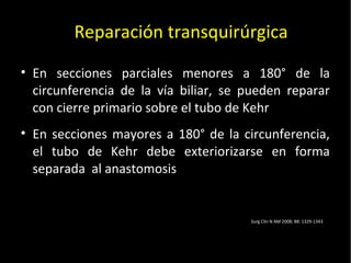 20/01/14
• En secciones parciales menores a 180° de la
circunferencia de la vía biliar, se pueden reparar
con cierre primario sobre el tubo de Kehr
• En secciones mayores a 180° de la circunferencia,
el tubo de Kehr debe exteriorizarse en forma
separada al anastomosis
Reparación transquirúrgica
Surg Clin N AM 2008; 88: 1329-1343
 