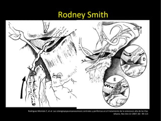 20/01/14
Rodney Smith
Rodriguez-Montalv F, et al. Las colangioyeyeunoanasomosis centrales y perifericas en el tratamiento de la estenossis alta de las Vias
biliares. Rev Ven Cir 2007; 60: 99-113
 