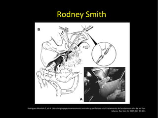 20/01/14
Rodney Smith
Rodriguez-Montalv F, et al. Las colangioyeyeunoanasomosis centrales y perifericas en el tratamiento de la estenossis alta de las Vias
biliares. Rev Ven Cir 2007; 60: 99-113
 