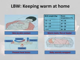 Low and Very Low Birth Weight Babies: Prevention Tips for