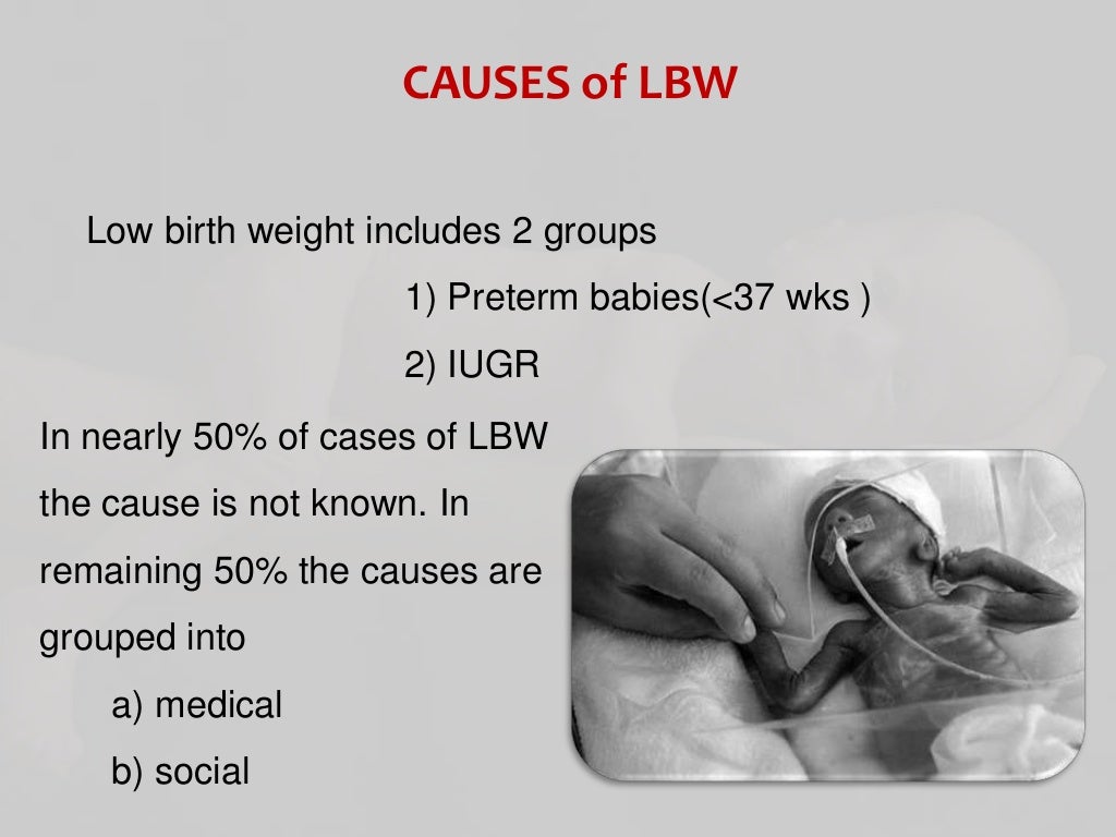Low birth weight