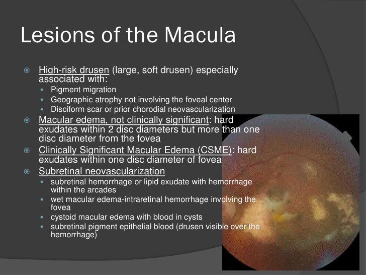 LC 092011Broader Blindness Prevention