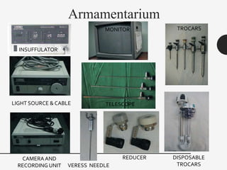 Armamentarium
INSUFFULATOR
CAMERAAND
RECORDING UNIT
LIGHT SOURCE & CABLE
MONITOR TROCARS
DISPOSABLE
TROCARS
TELESCOPE
REDUCER
VERESS NEEDLE
 