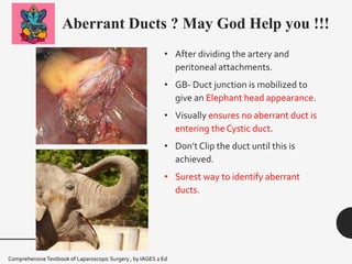 Aberrant Ducts ? May God Help you !!!
• After dividing the artery and
peritoneal attachments.
• GB- Duct junction is mobilized to
give an Elephant head appearance.
• Visually ensures no aberrant duct is
entering the Cystic duct.
• Don’t Clip the duct until this is
achieved.
• Surest way to identify aberrant
ducts.
ComprehensiveTextbook of Laparoscopic Surgery , by IAGES 2 Ed
 