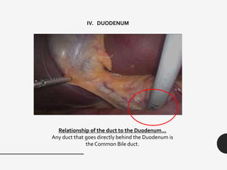 IV. DUODENUM
Relationship of the duct to the Duodenum…
Any duct that goes directly behind the Duodenum is
the Common Bile duct.
 