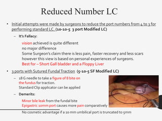Reduced Number LC
• Initial attempts were made by surgeons to reduce the port numbers from 4 to 3 for
performing standard LC. (10-10-5 3 port Modified LC)
– It’s Fallacy:
vision achieved is quite different
no major difference
Some Surgeon’s claim there is less pain, faster recovery and less scars
however this view is based on personal experiences of surgeons.
Best for – Short Gall bladder and a Floppy Liver
• 3 ports with Sutured FundalTraction (5-10-5 SF Modified LC)
– 18 G needle to take a figure of 8 bite on
the fundus for traction.
Standard Clip applicator can be applied
– Demerits:
Minor bile leak from the fundal bite
Epigastric 10mm port causes more pain comparatively
No cosmetic advantage if a 10 mm umbilical port is truncated to 5mm
 