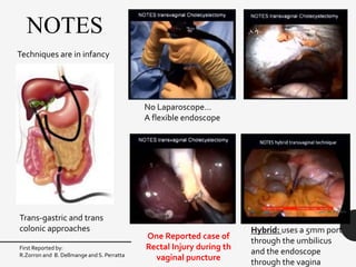 NOTES
No Laparoscope…
A flexible endoscope
Hybrid: uses a 5mm port
through the umbilicus
and the endoscope
through the vagina
Trans-gastric and trans
colonic approaches
First Reported by:
R.Zorron and B. Dellmange and S. Perratta
Techniques are in infancy
One Reported case of
Rectal Injury during th
vaginal puncture
 
