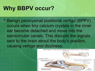 LC 7 Vestibular Disorders (1).pptttttttt | PPT