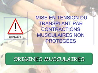 DANGER MISE EN TENSION DU TRANSPLANT PAR CONTRACTIONS MUSCULAIRES NON PROTÉGÉES ORIGINES MUSCULAIRES 