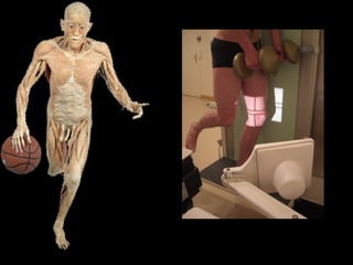 appui monopodal port 5kg x 2 PRÉ-OPÉRATOIRE 