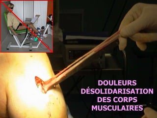 FPM DOULEURS DÉSOLIDARISATION DES CORPS MUSCULAIRES 