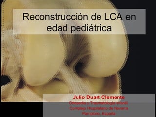 Reconstrucción de LCA en
edad pediátrica
Julio Duart Clemente
Ortopedia y Traumatología Infantil
Complejo Hospitalario de Navarra
Pamplona, España
 