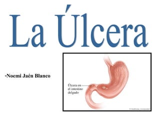 La Úlcera -Noemi Jaén Blanco 