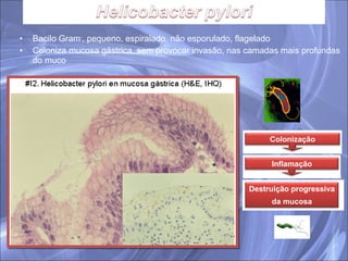 Bacilo Gram - , pequeno, espiralado, não esporulado, flagelado Coloniza mucosa gástrica, sem provocar invasão, nas camadas mais profundas do muco Destruição progressiva  da mucosa Colonização Inflamação 