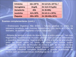 Exames complementares (cont.): Endoscopia Digestiva Alta (EDA) – “úlcera gástrica no antro, na pequena curvatura, com mucosa hiperemiada, com cerca de 8 mm de diâmetro, de bordos regulares e fundo nacarado” Biópsia de bordos e fundo da úlcera, corpo e antro gástrico - “em dois fragmentos, reconhece-se mucosa gástrica com processo inflamatório e aspectos hiperplásicos, regenerativos, fibrina e tecido de granulação, tanto no bordo como no fundo da úlcera. Dos outros quatro fragmentos, dois são de mucosa do corpo e dois da mucosa do tipo pilórico com gastrite crónica activa intensa, com atrofia moderada, metaplasia intestinal completa multifocal e grande quantidade de bacilos com as características morfológicas do  H. pylori”. 