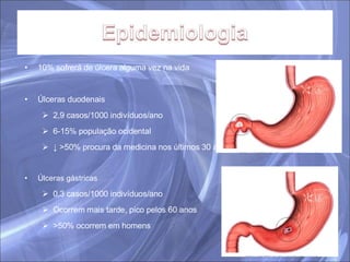 10% sofrerá de úlcera alguma vez na vida Úlceras duodenais 2,9 casos/1000 indivíduos/ano 6-15% população ocidental ↓  >50% procura da medicina nos últimos 30 anos Úlceras gástricas 0,3 casos/1000 indivíduos/ano Ocorrem mais tarde, pico pelos 60 anos >50% ocorrem em homens 