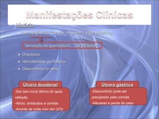 História Dor epigástrica (comum mas com ↓ valor preditivo) Dispepsia Hematemese ou melena Desconforto no peito “ sensação de queimadura”, “dor de fome” Úlcera duodenal Úlcera gástrica -Dor tem início 90min-3h após refeição Alívio: antiácidos e comida Acorda de noite com dor (2/3) -Desconforto pode ser precipitado pela comida Náuseas e perda de peso 