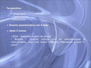 Terapêutica:  Omeprazol Claritromicina Amoxicilina  Doente assintomático em 5 dias. Após 2 meses EDA - “pequena cicatriz da úlcera” Biópsia – “gastrite crónica com as características já mencionadas, mas com menor infiltrado inflamatório e sem  H. pylori ” 