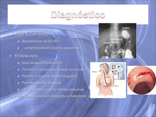 Raio X com bário Sensibilidade de 80-90% ↓  sensibilidade em úlceras pequenas Endoscopia Mais sensível e específico Permite a visualização directa da mucosa Permite a documentação fotográfica Permite efectuar biopsias Útil na identificação de lesões pequenas que não são visíveis pela radiografia e determinar zona de perda de sangue 