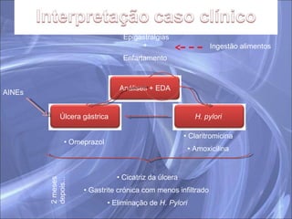 Epigastralgias +  Enfartamento  Claritromicina Amoxicilina Omeprazol Cicatriz da úlcera Gastrite crónica com menos infiltrado  Eliminação de  H. Pylori 2 meses depois... Ingestão alimentos AINEs Análises + EDA Úlcera gástrica  H. pylori   