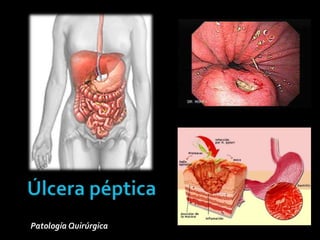 Patología Quirúrgica
 