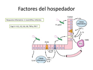 Factores del hospedador
Respuesta inflamatoria → neutrófilos, linfocitos
Cag A → IL1, IL2, IL6, IL8, TNFα, IFN ϒ
 
