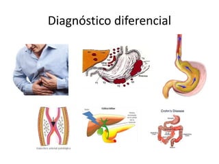 Diagnóstico diferencial
 