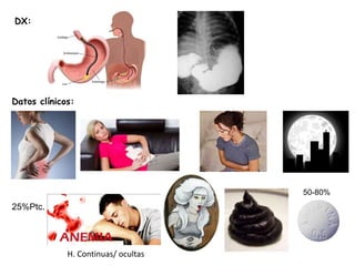 DX:
Datos clínicos:
25%Ptc.
H. Continuas/ ocultas
50-80%
 